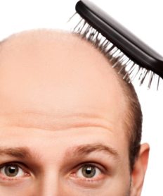Cómo detener la caída de cabello