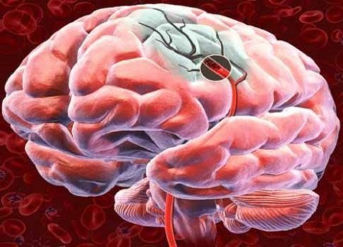 5 remedios naturales para oxigenar el cerebro