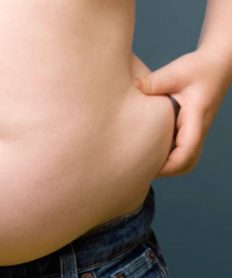 ¿Qué es la obesidad?