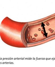 ¿Cómo sucede la hipertensión arterial?